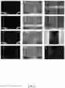 Fig. 08 - Apparatus for performing contactless optically-induced dielectrophoresis for separation of circulating tumor cells