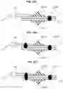 Fig. 03 - Laser welding method