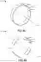 Fig. 05 - Method of removing bearing compartment