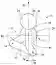 Fig. 01 - Robot having arm with offset