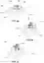 Fig. 15 - INTERNALLY HOLLOW BODY, MOLD AND METHOD THEREOF