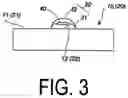 Fig. 04 - MEDICAL APPARATUS AND METHOD FOR MANUFACTURING SAME