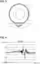 Fig. 04 - Collision detecting device