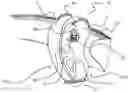 Fig. 01 - Curved airbag and method of manufacturing