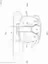 Fig. 04 - Airbag