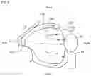 Fig. 06 - Airbag