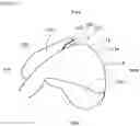 Fig. 15 - Airbag