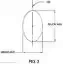 Fig. 04 - Methods and apparatus for selective stiffness of vehicle suspension