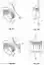 Fig. 02 - Support member