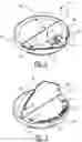 Fig. 03 - Closing Unit