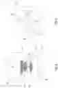 Fig. 03 - TAMPER-EVIDENT COUPLING SYSTEM, PROCESS OF MAKING SAID COUPLING SYSTEM, CONTAINER COMPRISING SAID COUPLING SYSTEM AND USE THEREOF