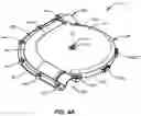 Fig. 07 - Chain disk corner