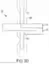 Fig. 07 - Chain link adapter