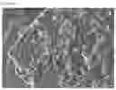 Fig. 01 - Anhydrous dibasic calcium phosphate, and method for producing same