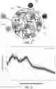 Fig. 04 - Low temperature synthesis of aluminum hydr(oxide) inside porous media
