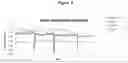 Fig. 07 - Electrodes for cost-effective bio-electrochemical systems