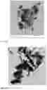 Fig. 08 - Sulfidated nanoscale zerovalent iron and method of use thereof