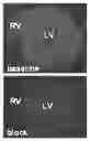Fig. 01 - Voltage gated sodium channel imaging agents