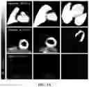 Fig. 09 - Voltage gated sodium channel imaging agents