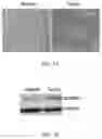 Fig. 02 - AURKB SMALL-MOLECULE INHIBITORS AND USES THEREOF