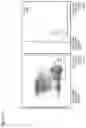Fig. 06 - Human APOB100 epitopes, methods and uses for modulating inflammatory responses, and treating adverse cardiovascular events, disease and atherosclerosis