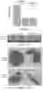 Fig. 02 - Methods of treating cancer by administering inhibitory RNA molecules targeting protease serine 2 (PRSS2) expression