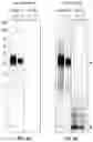 Fig. 04 - ANTIBODIES RECOGNIZING MEDIN