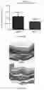 Fig. 41 - IL-11 antibodies