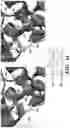 Fig. 18 - METHODS TO MANIPULATE ALPHA-FETOPROTEIN (AFP)