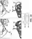 Fig. 22 - METHODS TO MANIPULATE ALPHA-FETOPROTEIN (AFP)