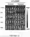 Fig. 14 - Drug delivery compositions and uses thereof