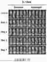 Fig. 15 - Drug delivery compositions and uses thereof