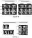 Fig. 30 - Drug delivery compositions and uses thereof