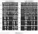 Fig. 31 - Drug delivery compositions and uses thereof
