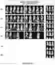 Fig. 32 - Drug delivery compositions and uses thereof