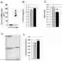 Fig. 01 - Methods for treating and/or reducing the likelihood of heart failure by administering anti-activin receptor type II (anti-ActRII) antibody