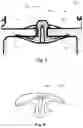 Fig. 05 - ELASTOMER COMPONENT EXPOSED TO BLOW-BY GASES OF AN INTERNAL COMBUSTION ENGINE