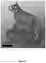 Fig. 08 - POLYMER COMPOSITIONS FOR 3-D PRINTING AND 3-D PRINTERS