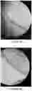 Fig. 43 - Methods, devices, and apparatus for washing samples on array plates