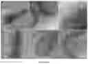Fig. 07 - Compositions and methods for long-term in vitro culture of the syphilis spirochete