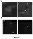 Fig. 08 - OPTOGENETICALLY TRANSFORMED PHOTORECEPTOR PRECURSOR CELLS FOR THE USE IN THE TREATMENT OF RETINAL DEGENERATIVE DISEASES