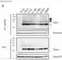 Fig. 06 - Natural killer cells
