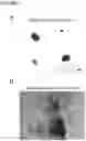 Fig. 16 - Methods and compositions for production of fallopian tube epithelium