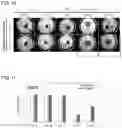 Fig. 11 - Cell cultivation method, cell support composite production method, cultivated cells, and cell support composite