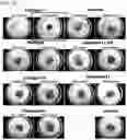 Fig. 12 - Cell cultivation method, cell support composite production method, cultivated cells, and cell support composite
