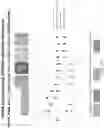 Fig. 114 - Methods for isolating microvesicles and extracting nucleic acids from biological samples
