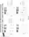 Fig. 162 - Methods for isolating microvesicles and extracting nucleic acids from biological samples