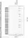 Fig. 164 - Methods for isolating microvesicles and extracting nucleic acids from biological samples
