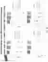 Fig. 187 - Methods for isolating microvesicles and extracting nucleic acids from biological samples
