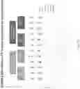 Fig. 79 - Methods for isolating microvesicles and extracting nucleic acids from biological samples